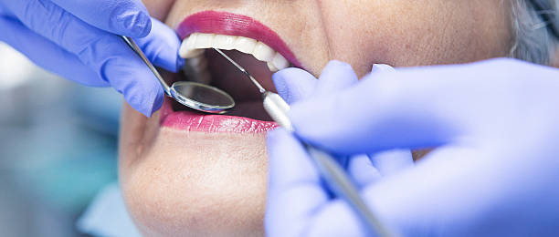 Best Broken Tooth Emergency  in Chase, PA